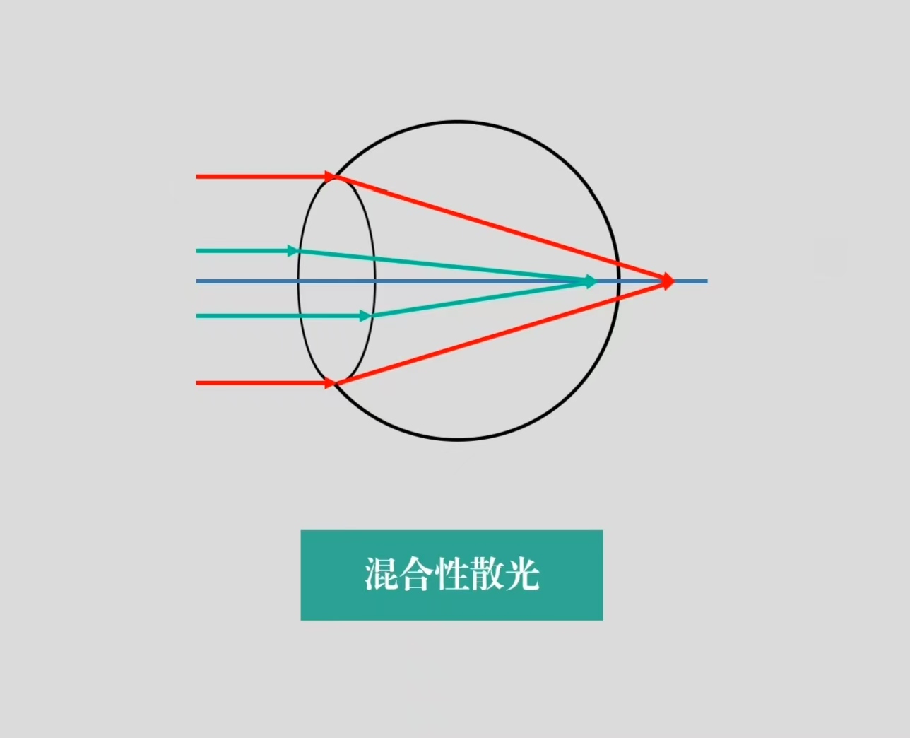 混合散光.jpg