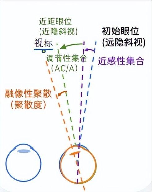 眼位调整过程.jpg