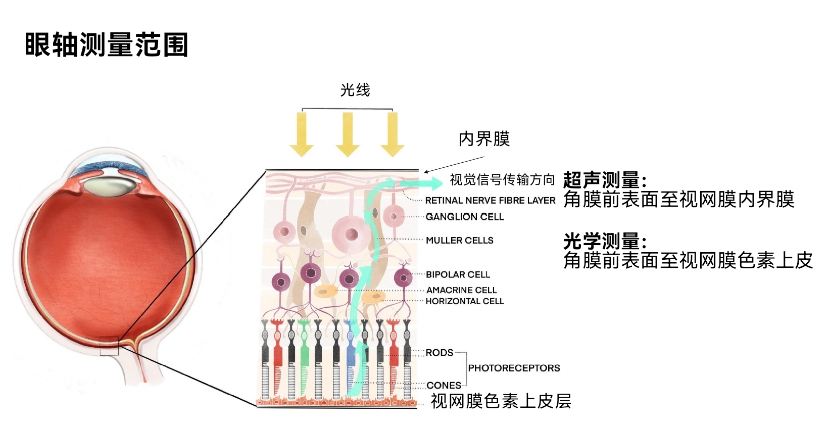 眼轴测量范围.jpg