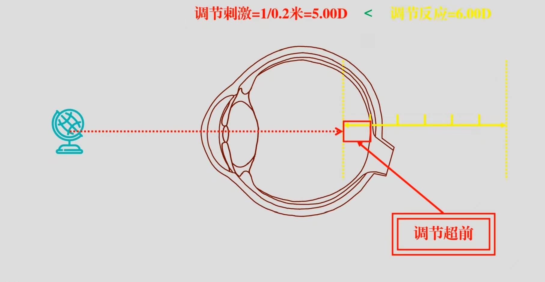 视功能调节篇四：调节刺激/反应，调节灵敏度/相对调节