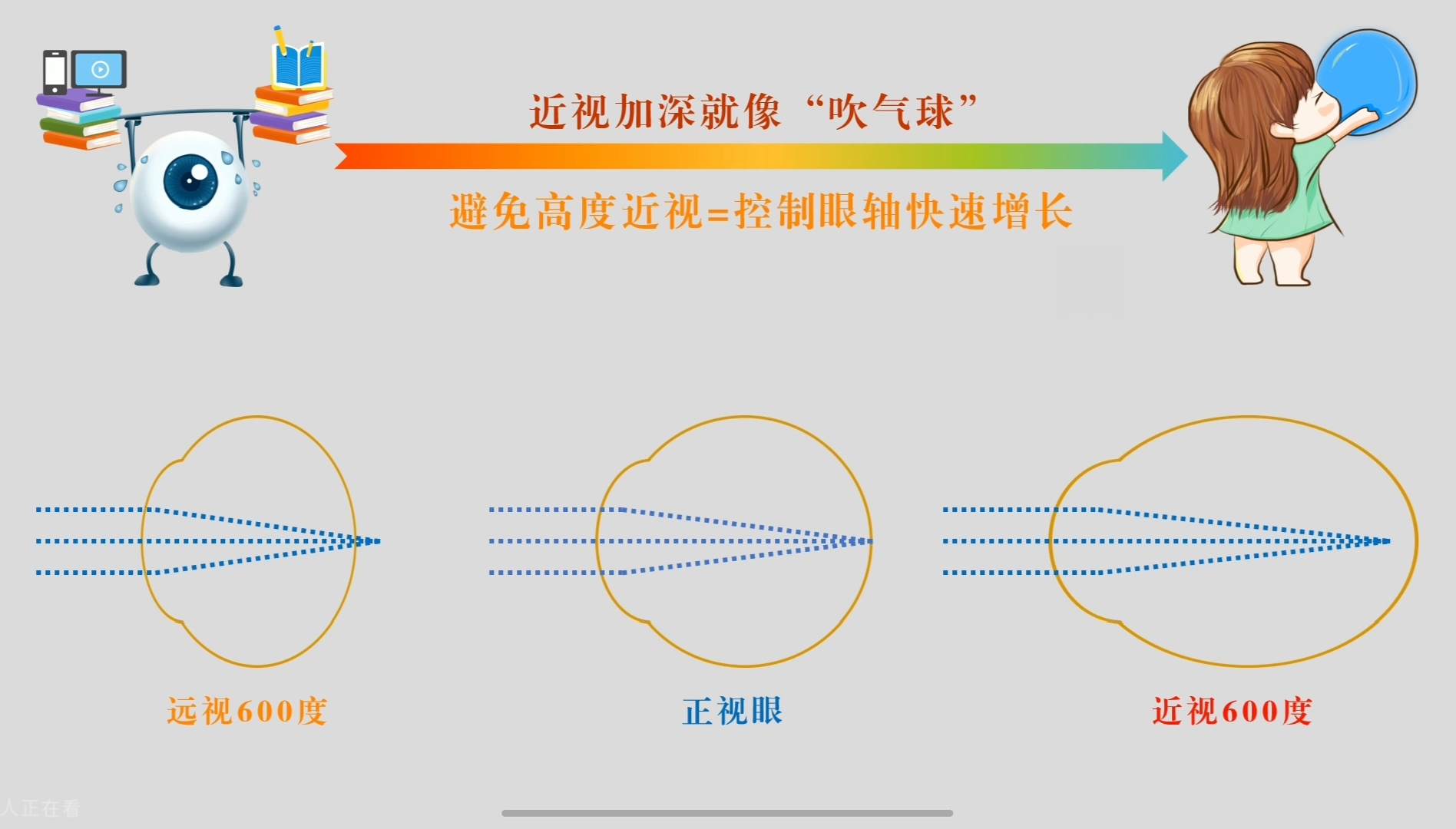 轴长与屈光.jpg