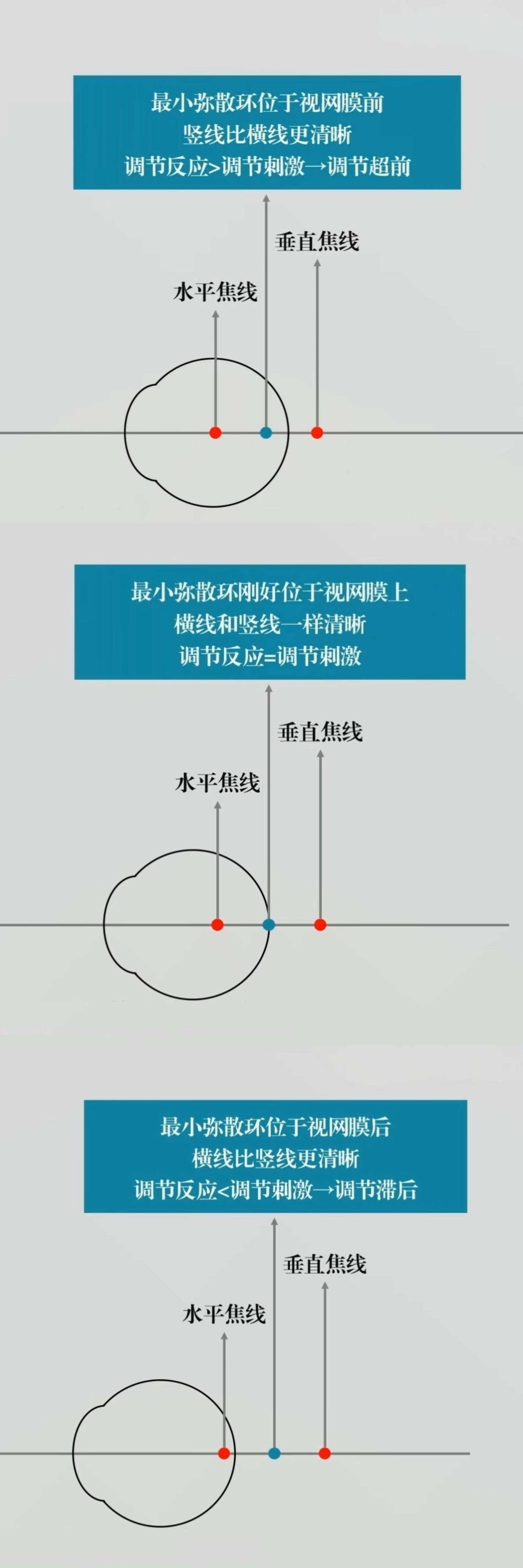 BCC检查图解.jpg